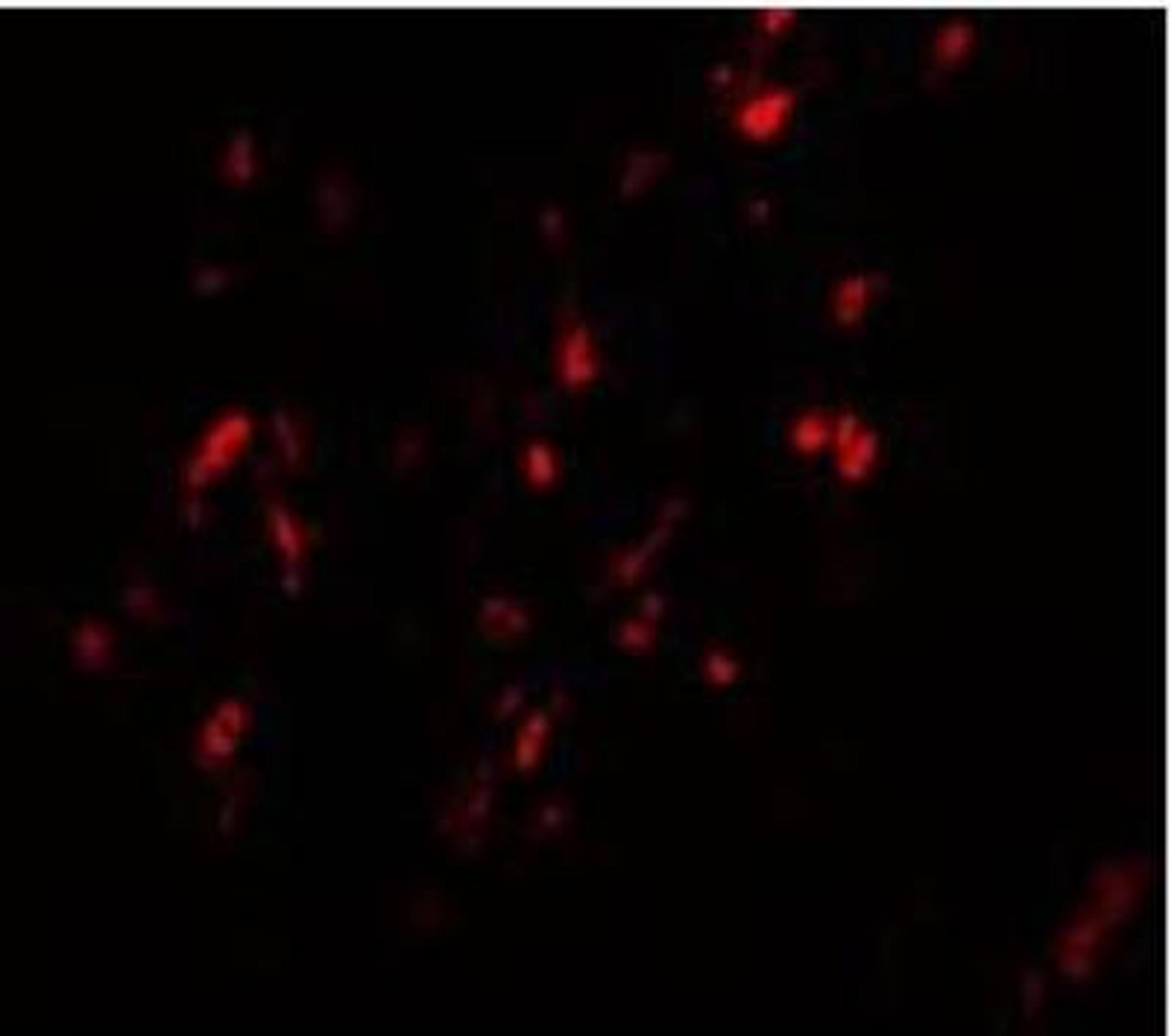 Immunocytochemistry/Immunofluorescence: BCAS1 Antibody [NBP1-77123] - Human Breast Carcinoma cells with BCAS1 antibody at 20 ug/mL.