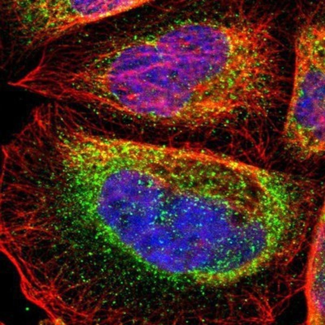 Immunocytochemistry/Immunofluorescence: COMT Antibody [NBP1-85818] - Staining of human cell line A-431 shows positivity in vesicles.