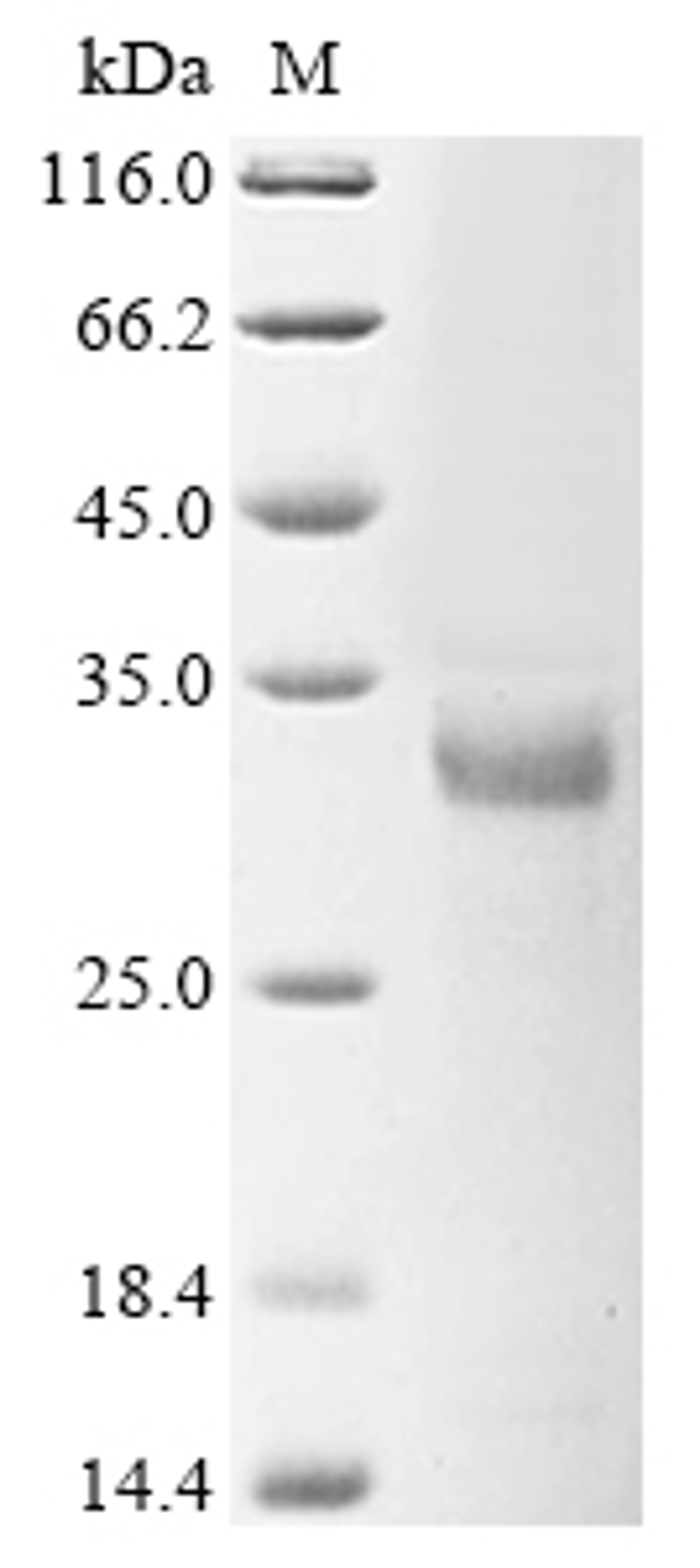 (Tris-Glycine gel) Discontinuous SDS-PAGE (reduced) with 5% enrichment gel and 15% separation gel.