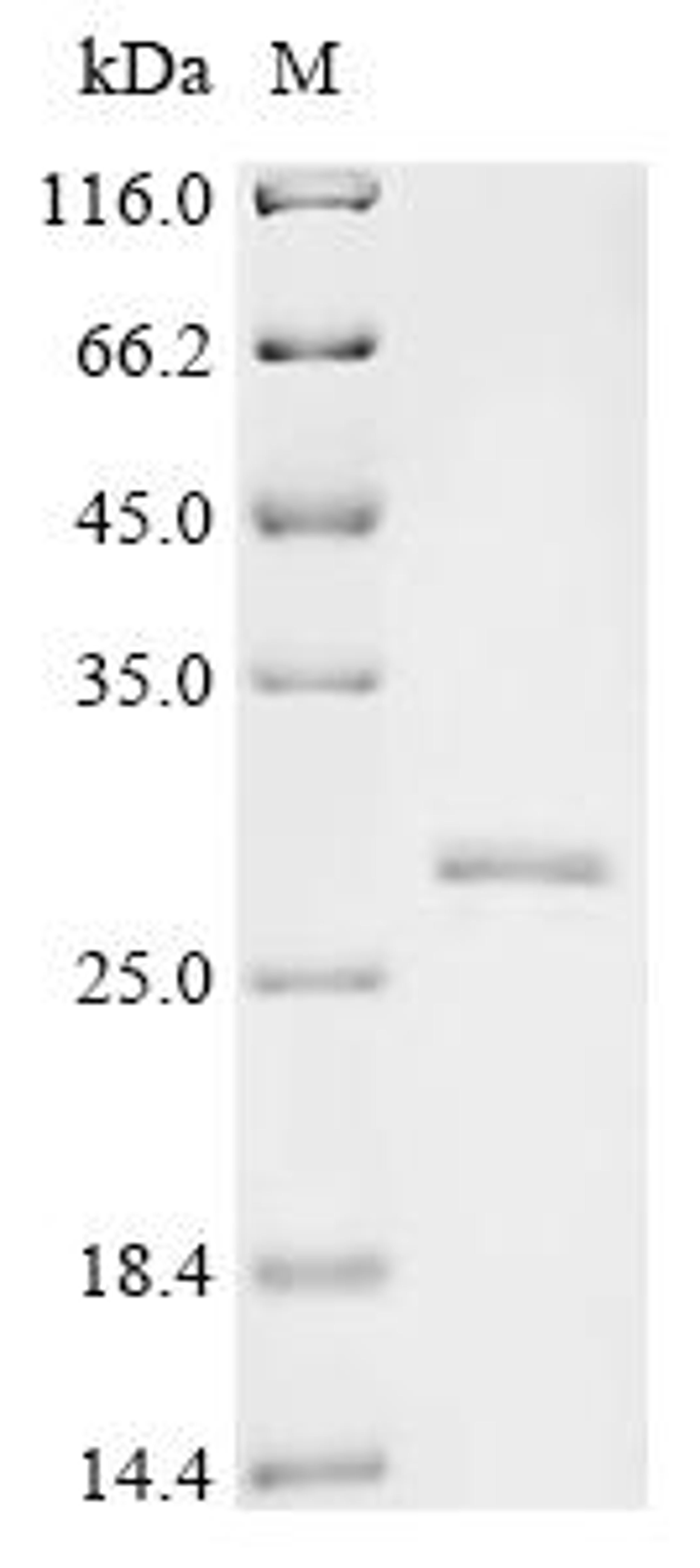 (Tris-Glycine gel) Discontinuous SDS-PAGE (reduced) with 5% enrichment gel and 15% separation gel.