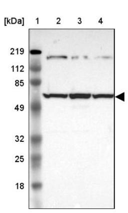 Western Blot: USP14 Antibody [NBP1-86946] - Lane 1: Marker [kDa] 219, 112, 85, 49, 32, 25, 18<br/>Lane 2: Human cell line RT-4<br/>Lane 3: Human cell line U-251MG sp<br/>Lane 4: Human cell line A-431