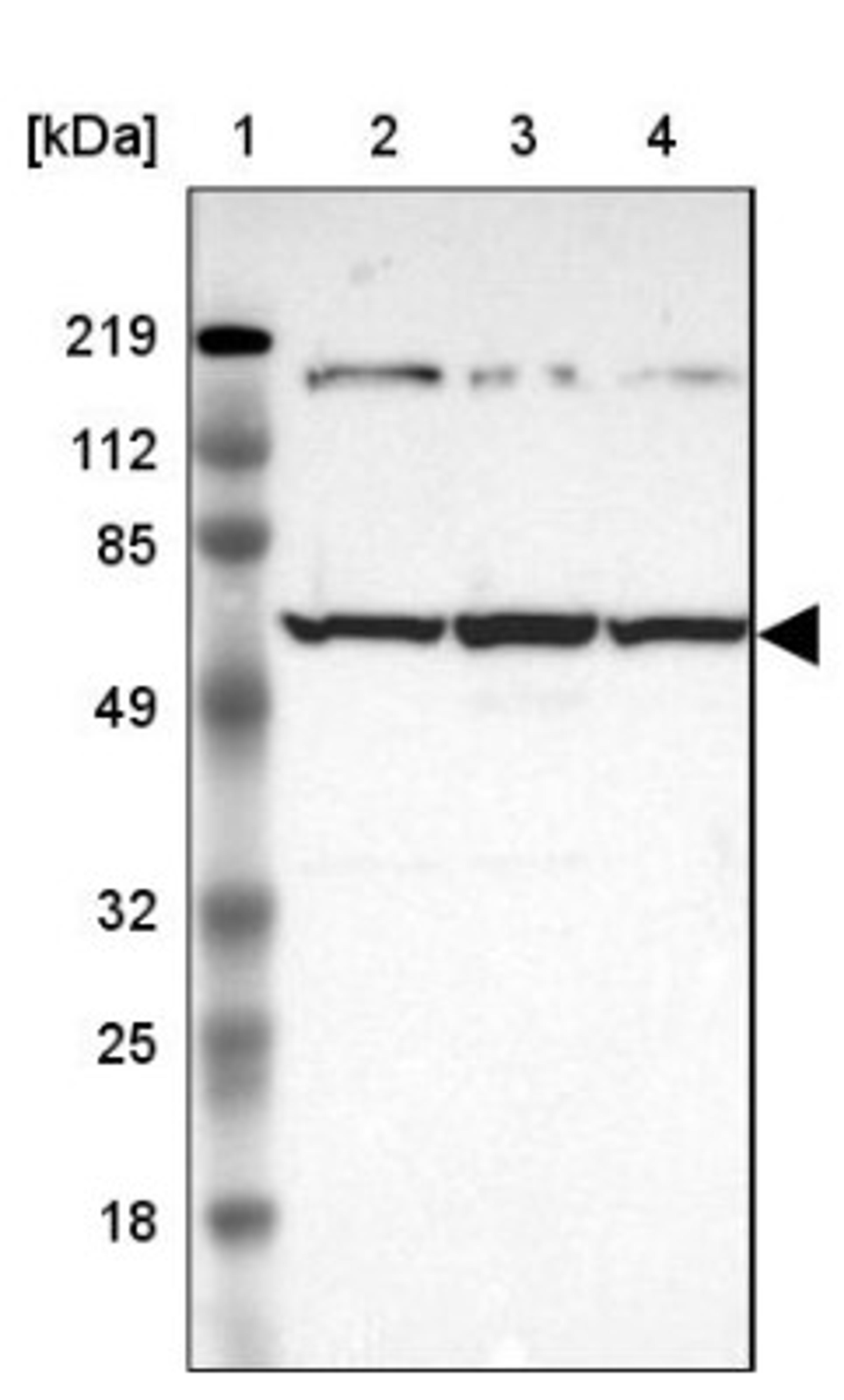 Western Blot: USP14 Antibody [NBP1-86946] - Lane 1: Marker [kDa] 219, 112, 85, 49, 32, 25, 18<br/>Lane 2: Human cell line RT-4<br/>Lane 3: Human cell line U-251MG sp<br/>Lane 4: Human cell line A-431