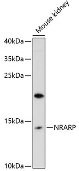 Western blot - NRARP antibody (A12875)