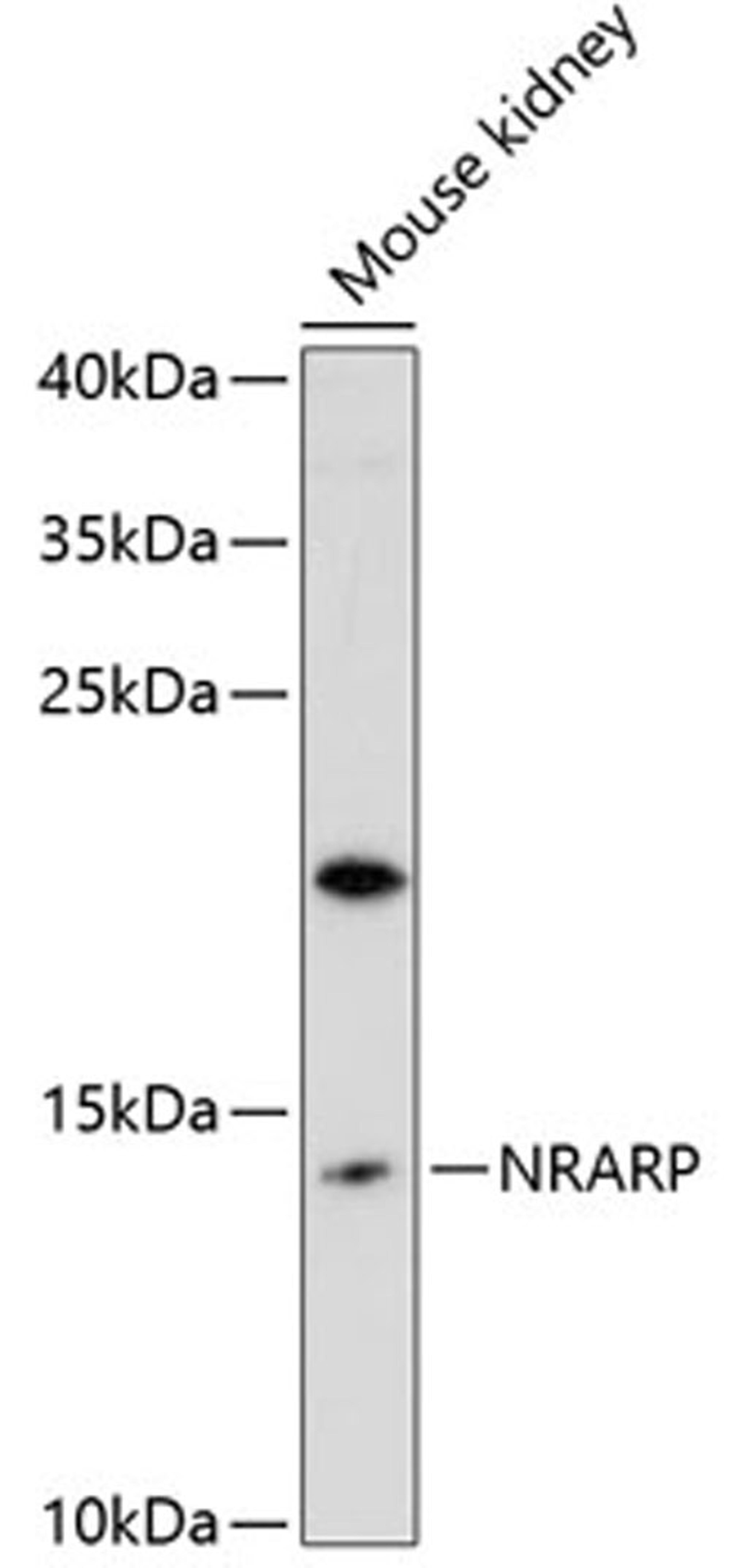 Western blot - NRARP antibody (A12875)