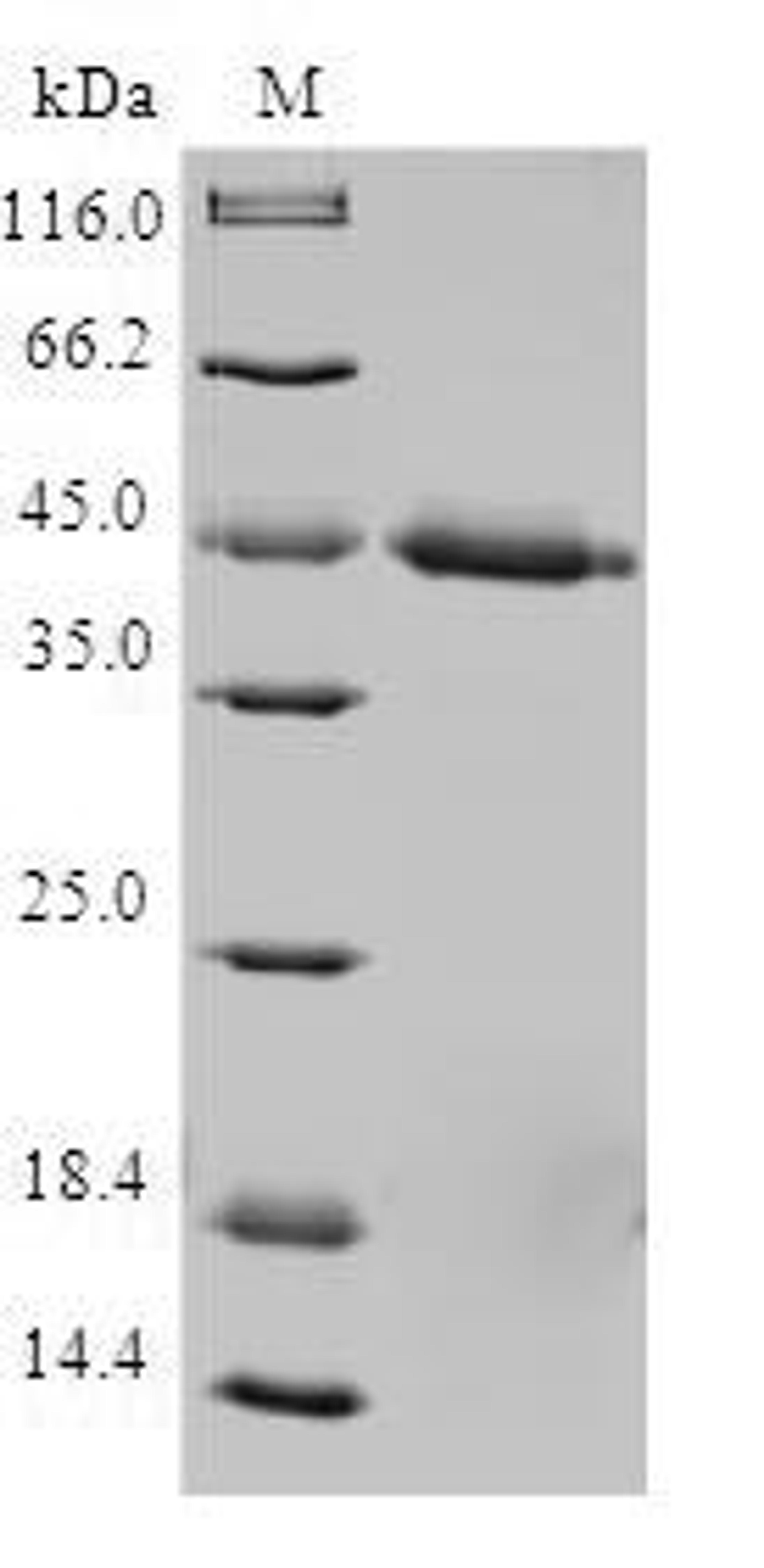 (Tris-Glycine gel) Discontinuous SDS-PAGE (reduced) with 5% enrichment gel and 15% separation gel.