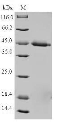 (Tris-Glycine gel) Discontinuous SDS-PAGE (reduced) with 5% enrichment gel and 15% separation gel.