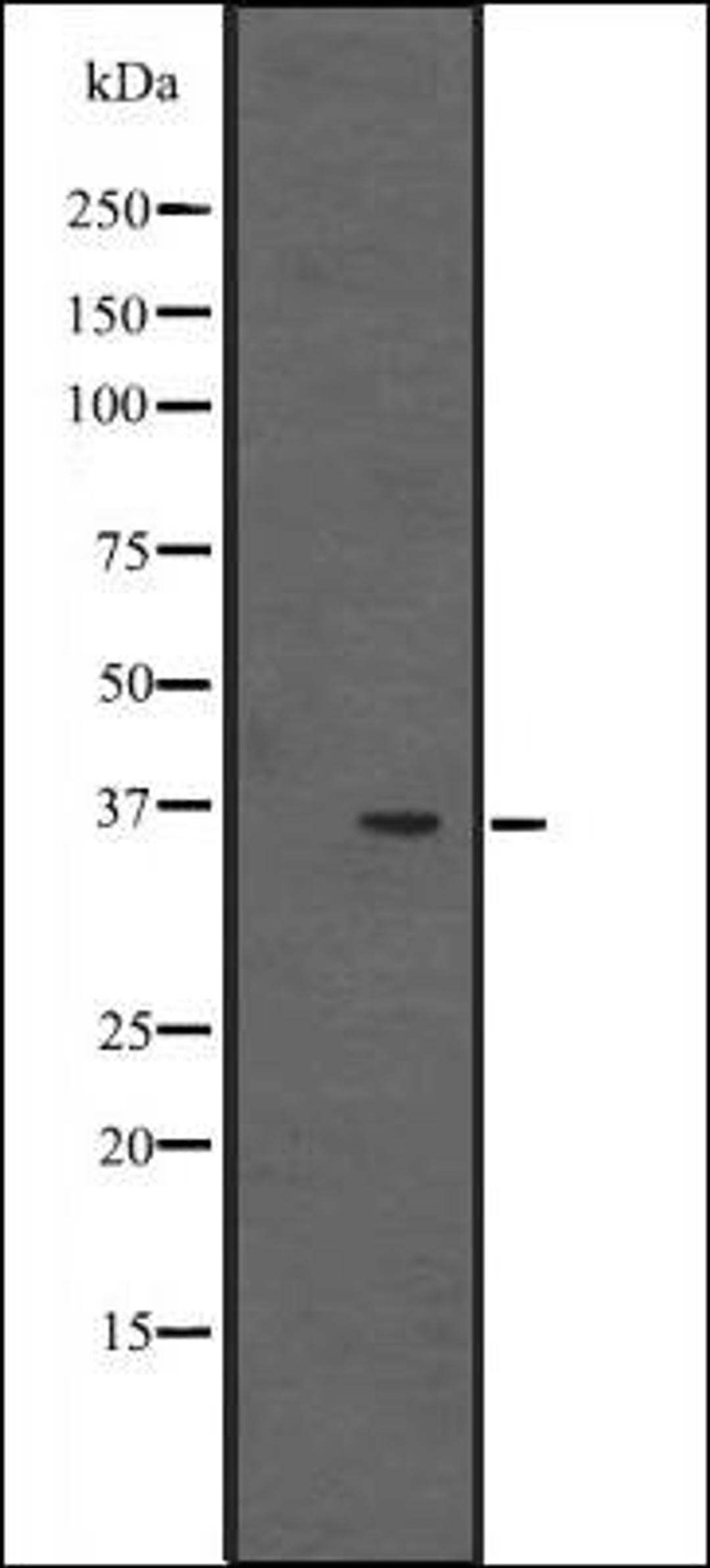 Western blot analysis of NCI-H292 cell line lysates using EBP2 antibody