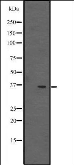 Western blot analysis of NCI-H292 cell line lysates using EBP2 antibody