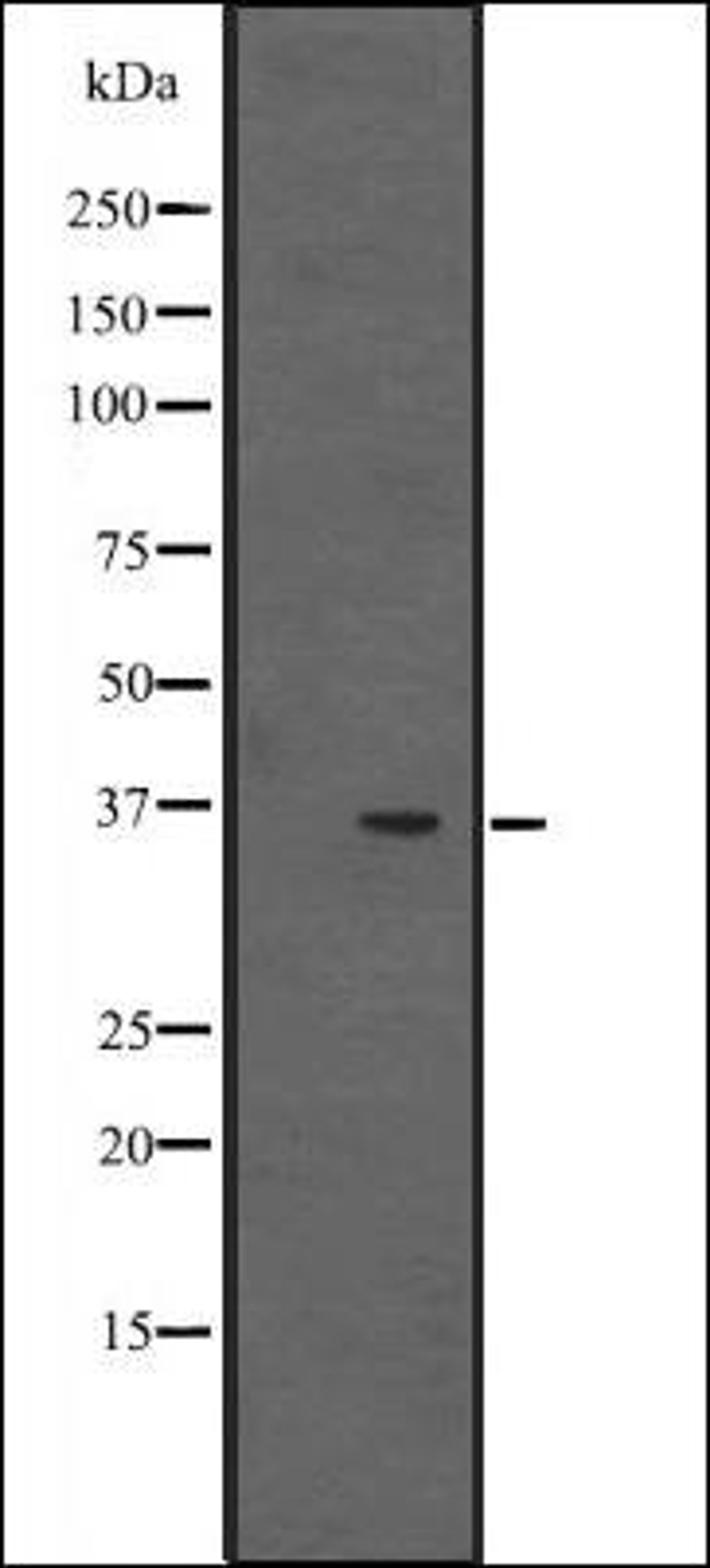 Western blot analysis of NCI-H292 cell line lysates using EBP2 antibody