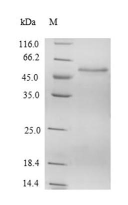 (Tris-Glycine gel) Discontinuous SDS-PAGE (reduced) with 5% enrichment gel and 15% separation gel.