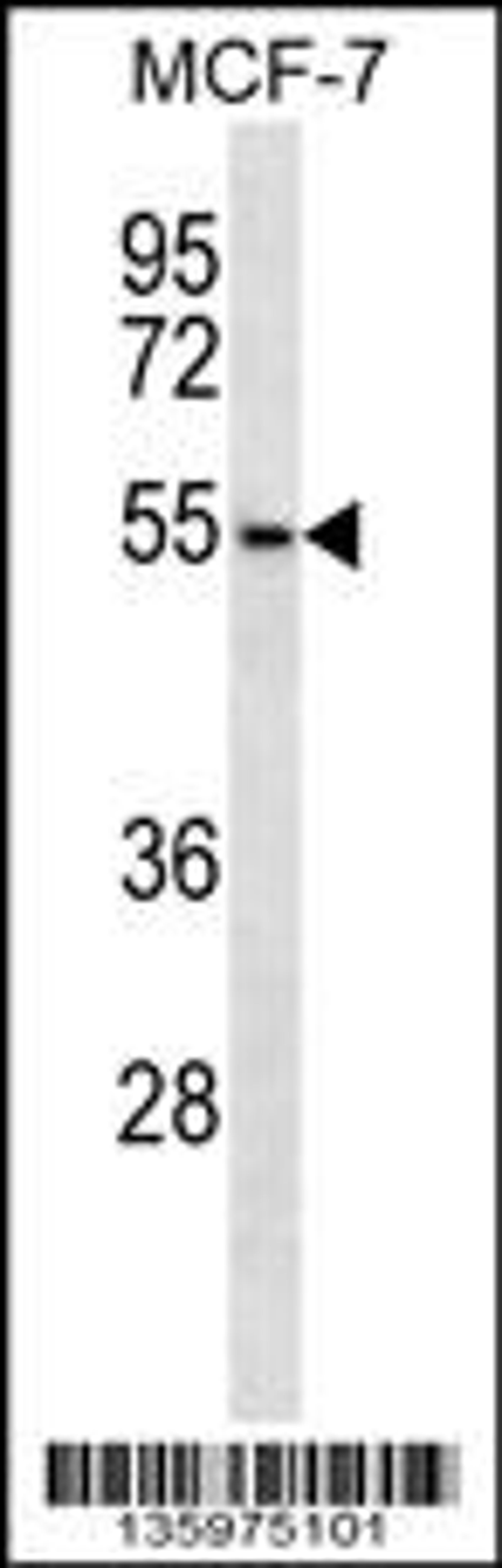 Western blot analysis in MCF-7 cell line lysates (35ug/lane).