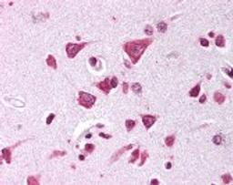 Immunohistochemistry staining of APBB2 in brain cortex tissue using APBB2 Antibody.