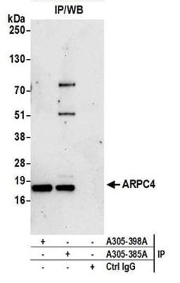 Detection of human ARPC4 by western blot of immunoprecipitates.