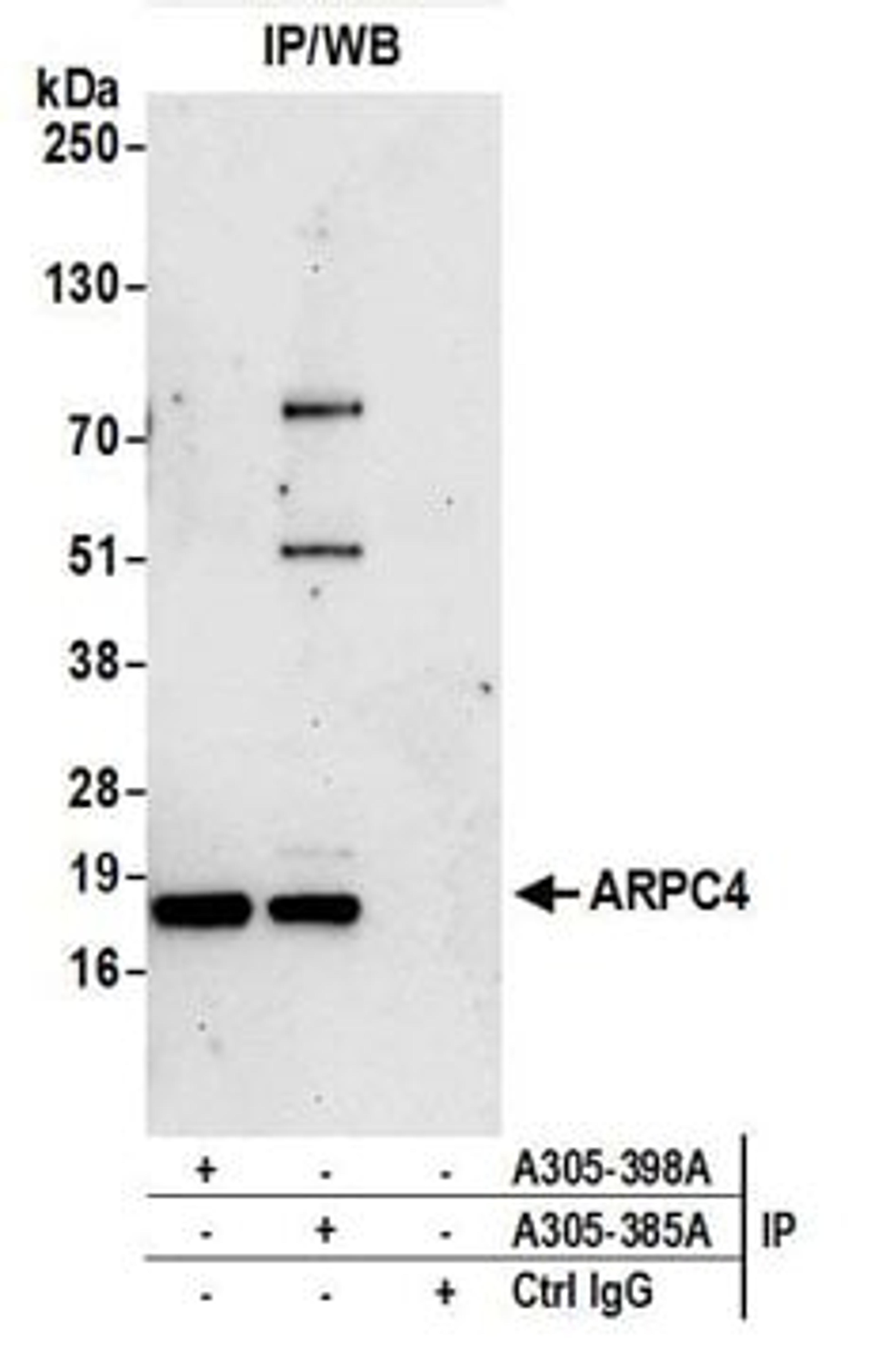 Detection of human ARPC4 by western blot of immunoprecipitates.