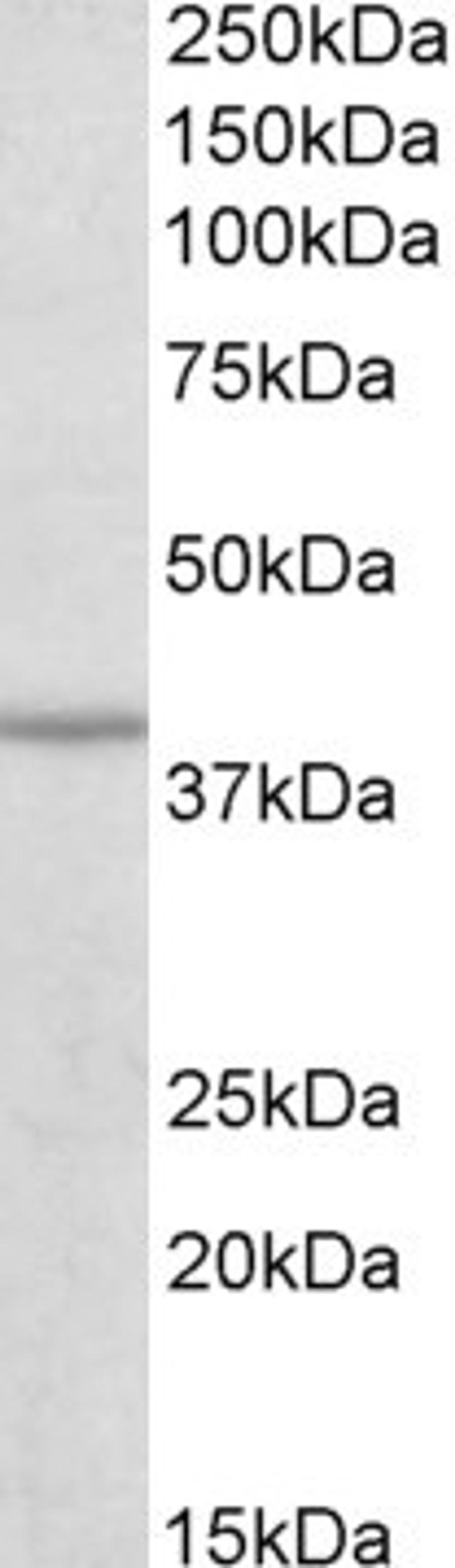 Western Blot: IDH3B Antibody [NBP1-78787] (0.3ug/ml) staining of Human Skeletal muscle lysate (35ug protein in RIPA buffer). Primary incubation was 1 hour. Detected by chemiluminescence.