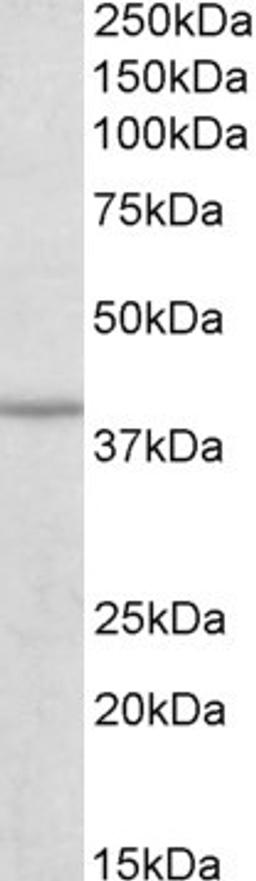 Western Blot: IDH3B Antibody [NBP1-78787] (0.3ug/ml) staining of Human Skeletal muscle lysate (35ug protein in RIPA buffer). Primary incubation was 1 hour. Detected by chemiluminescence.