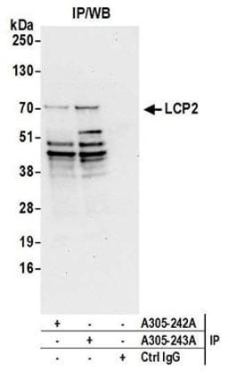 Detection of human LCP2 by western blot of immunoprecipitates.