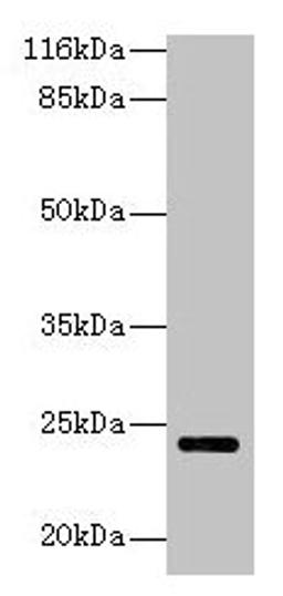 Western blot. All lanes: MTHFS antibody at 2µg/ml + Hela whole cell lysate. Secondary. Goat polyclonal to rabbit IgG at 1/10000 dilution. Predicted band size: 24, 21 kDa. Observed band size: 24 kDa