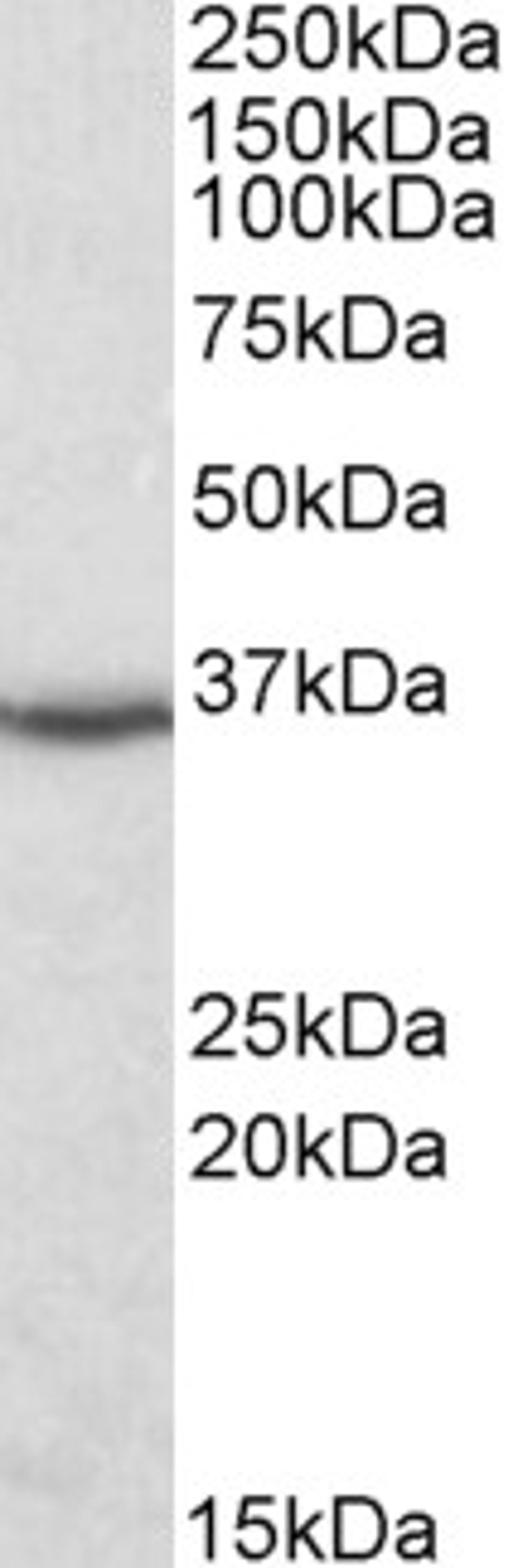 45-468 (0.1ug/ml) staining of Human Kideny lysate (35ug protein in RIPA buffer). Detected by chemiluminescence.