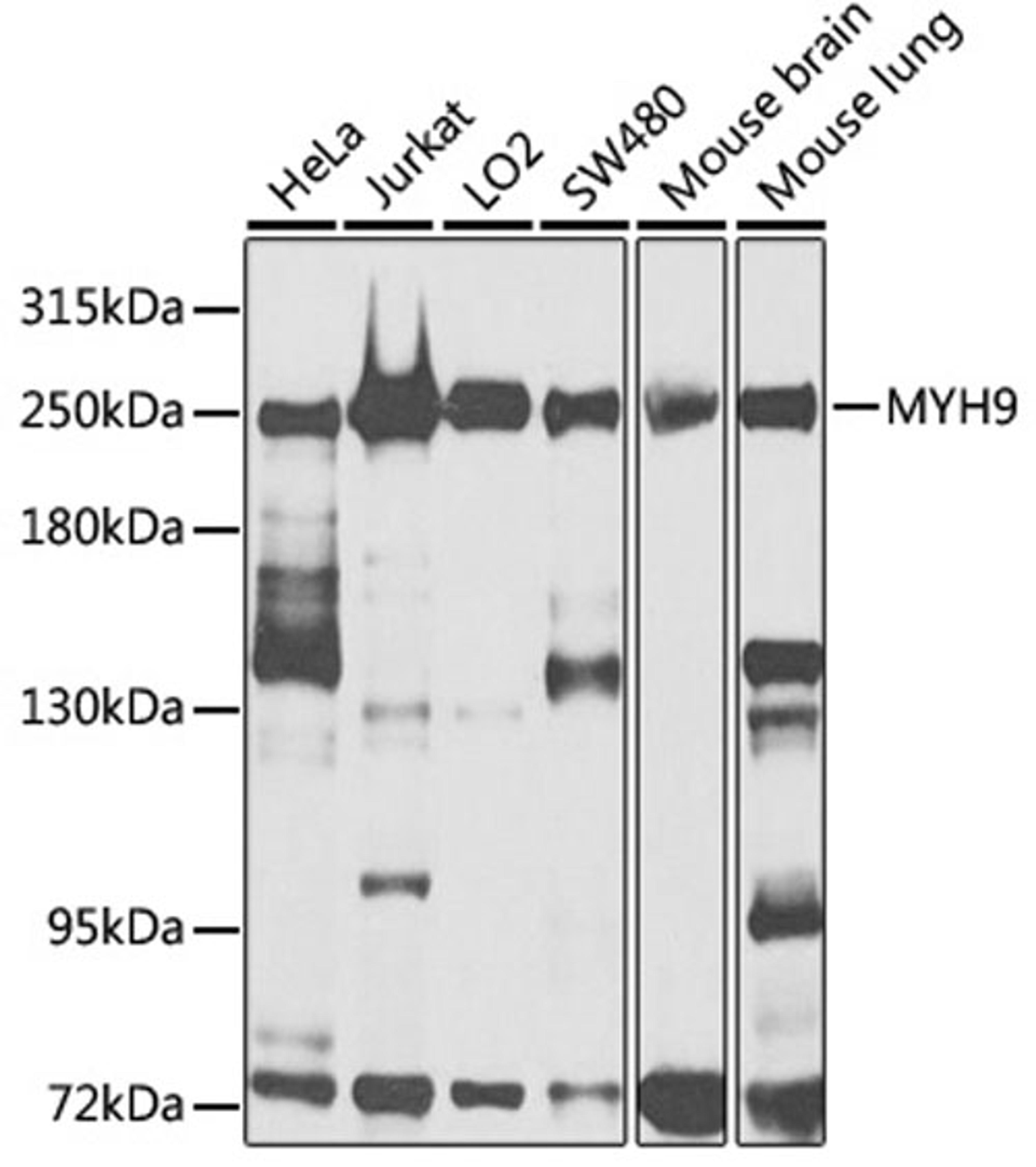 Western blot - MYH9 antibody (A16923)