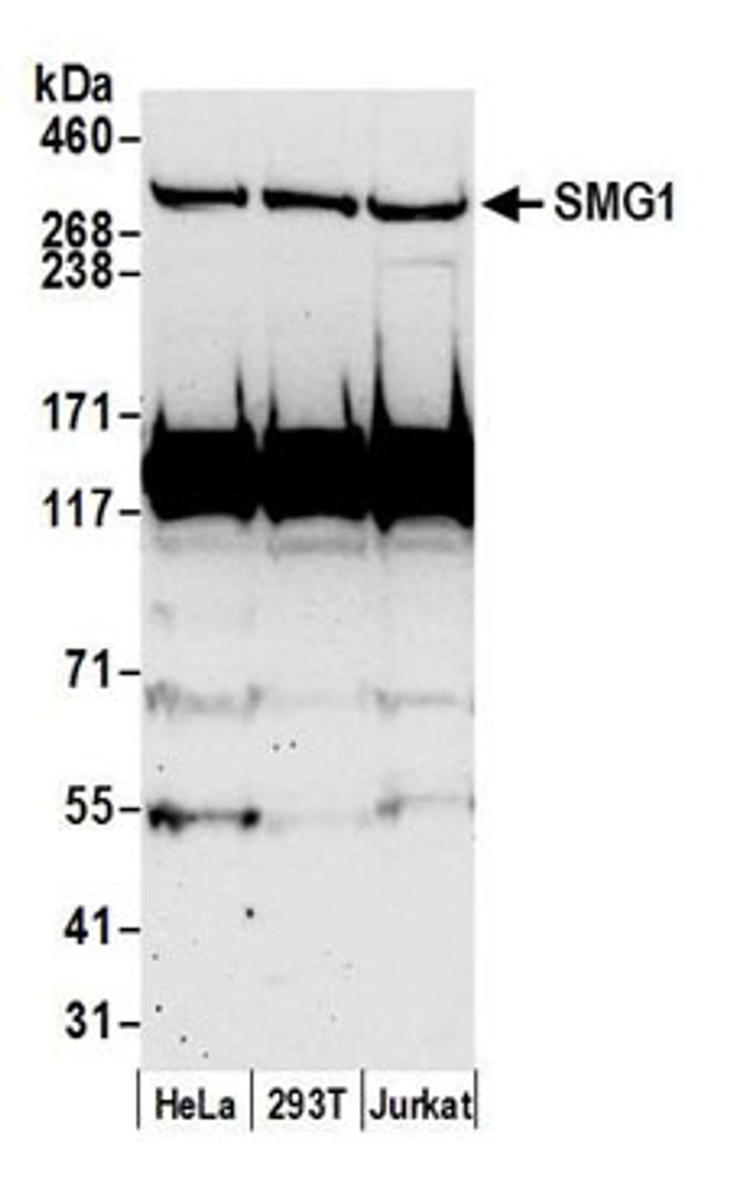 Detection of human SMG1 by western blot.