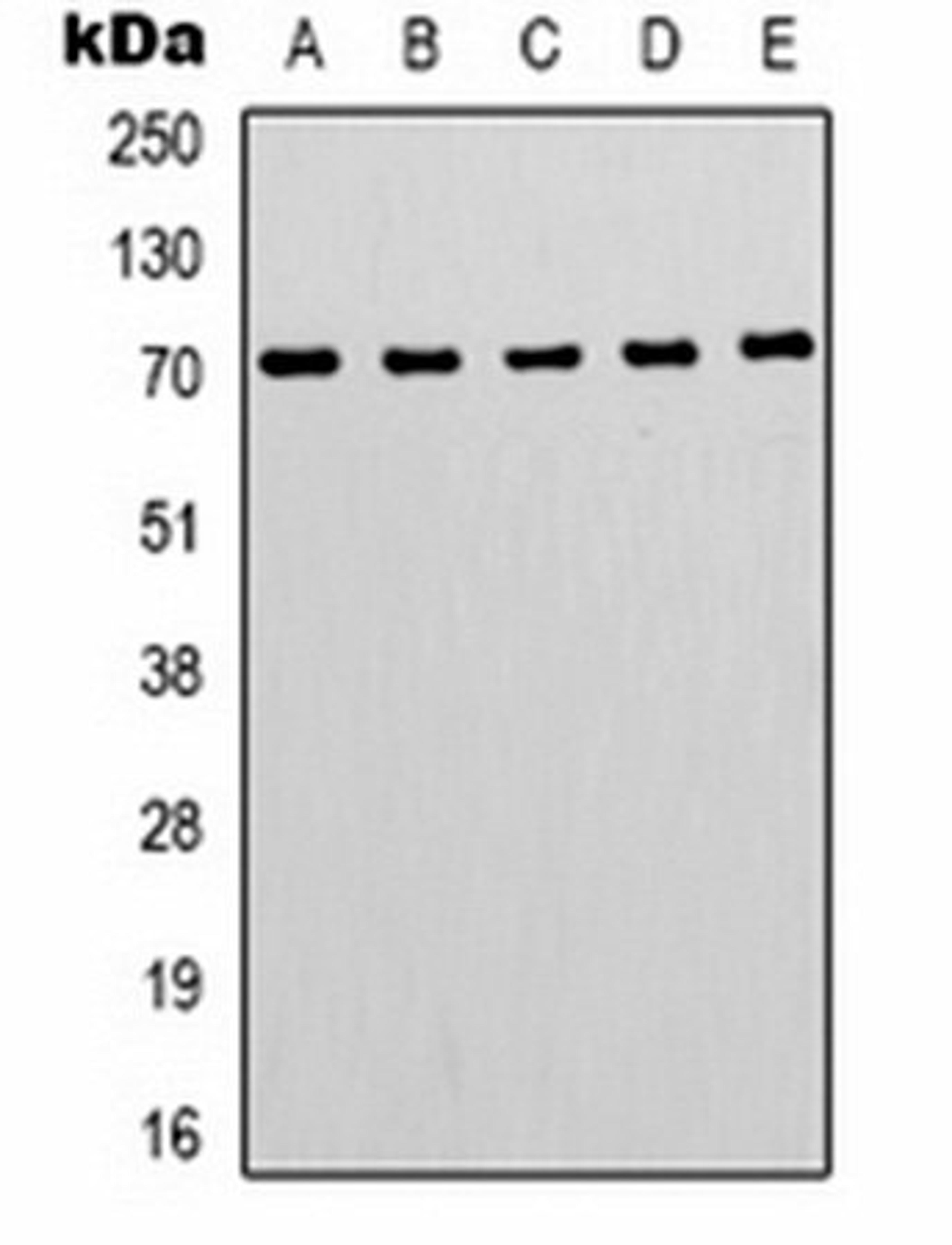 Western blot analysis of  Hela (Lane1), Jurkat (Lane2), mouse brain (Lane3), mouse kidney (Lane4), rat brain (Lane5) whole cell lysates using ZNF499 antibody