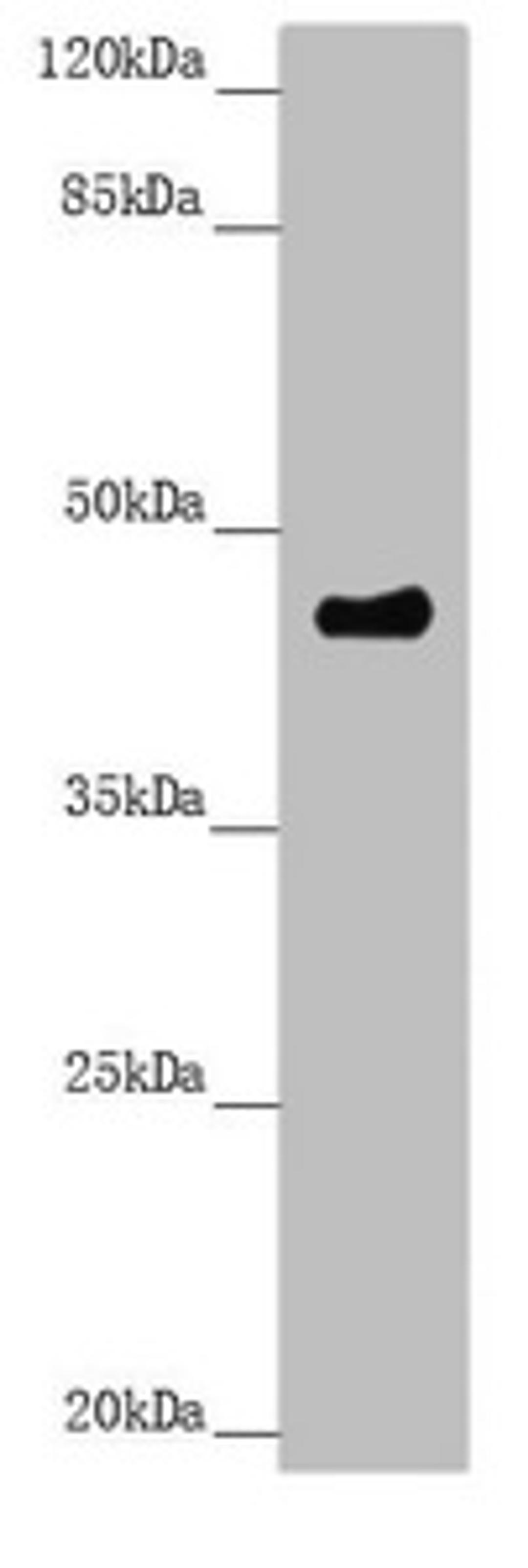 Western blot. All lanes: PLEKHA1 antibody at 3.11µg/ml + A549 whole cell lysate. Secondary. Goat polyclonal to rabbit IgG at 1/10000 dilution. Predicted band size: 46, 39 kDa. Observed band size: 46 kDa