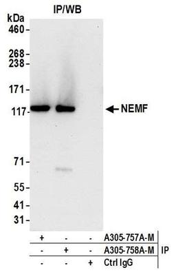 Detection of human NEMF by WB of IP.