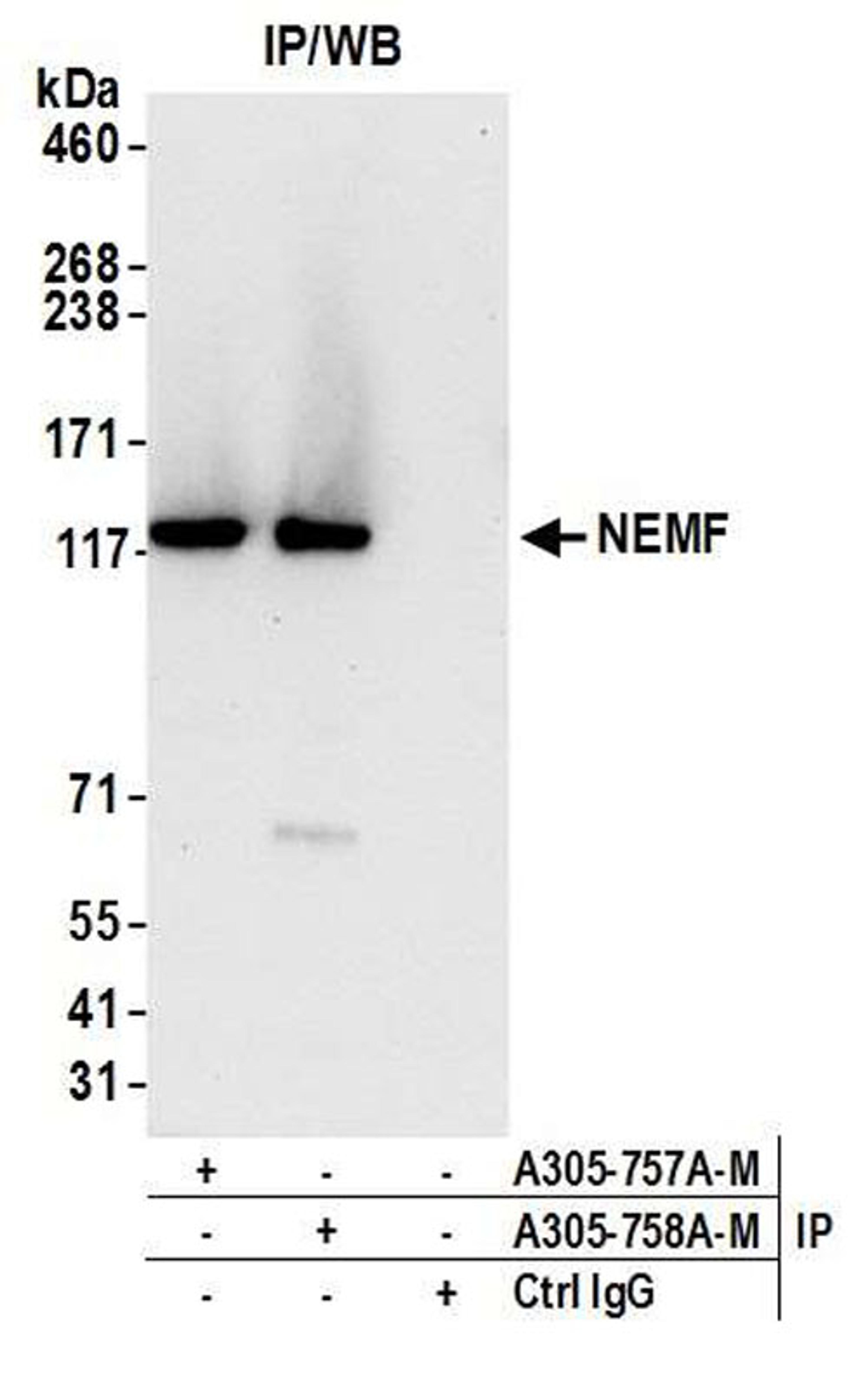 Detection of human NEMF by WB of IP.