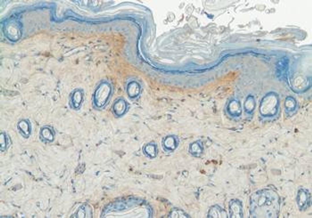 Immunohistochemical staining of rat skin using Collagen V antibody