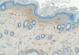 Immunohistochemical staining of rat skin using Collagen V antibody