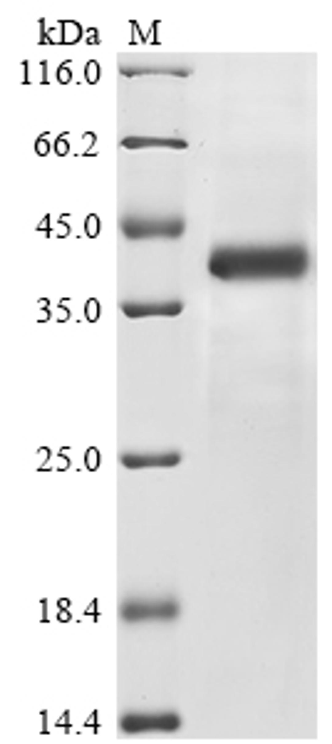 (Tris-Glycine gel) Discontinuous SDS-PAGE (reduced) with 5% enrichment gel and 15% separation gel.