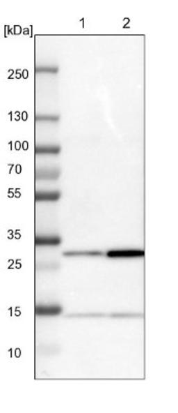 Western Blot: CCDC43 Antibody [NBP1-83536] - Lane 1: NIH-3T3 cell lysate (Mouse embryonic fibroblast cells)<br/>Lane 2: NBT-II cell lysate (Rat Wistar bladder tumour cells)