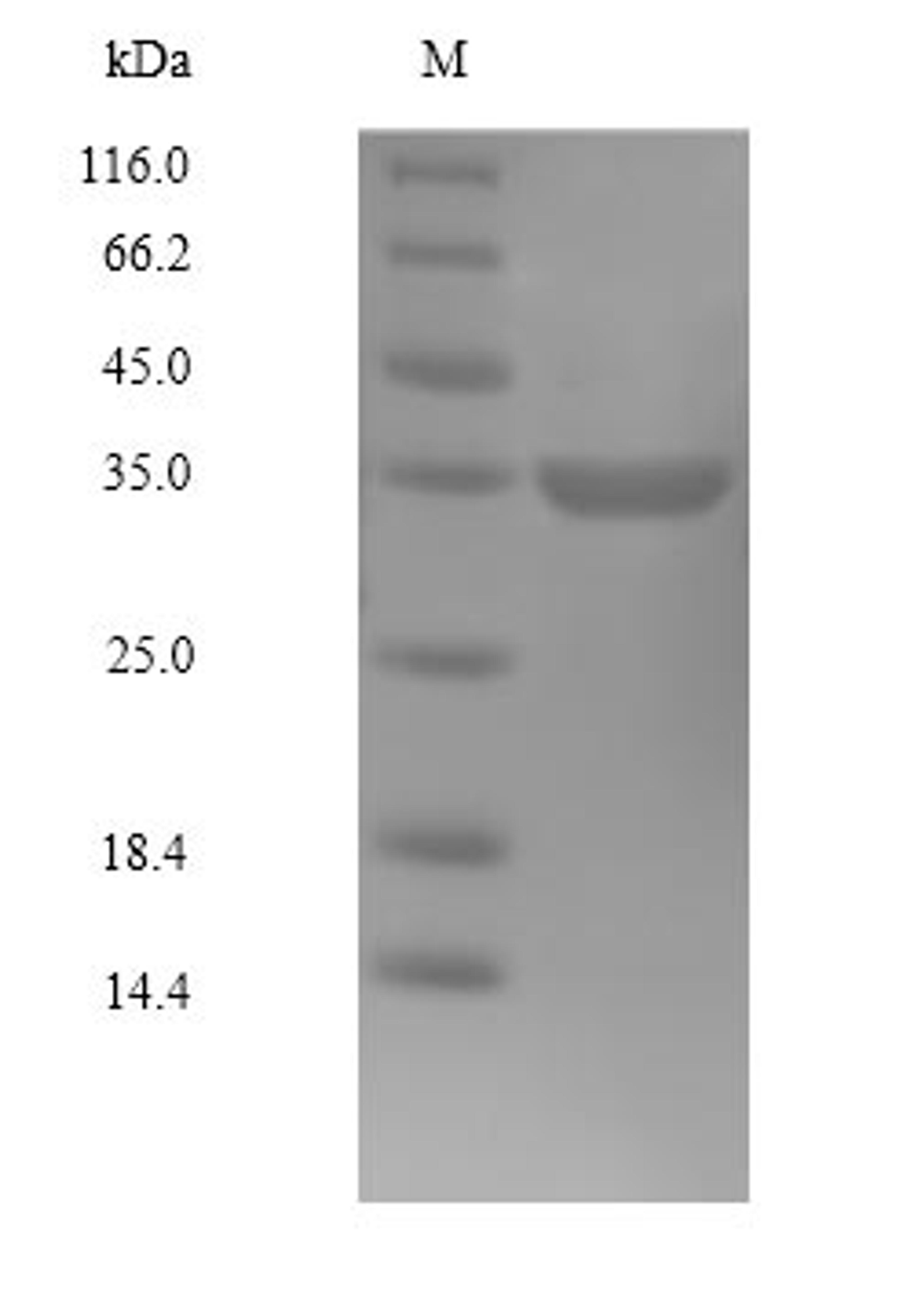 (Tris-Glycine gel) Discontinuous SDS-PAGE (reduced) with 5% enrichment gel and 15% separation gel.