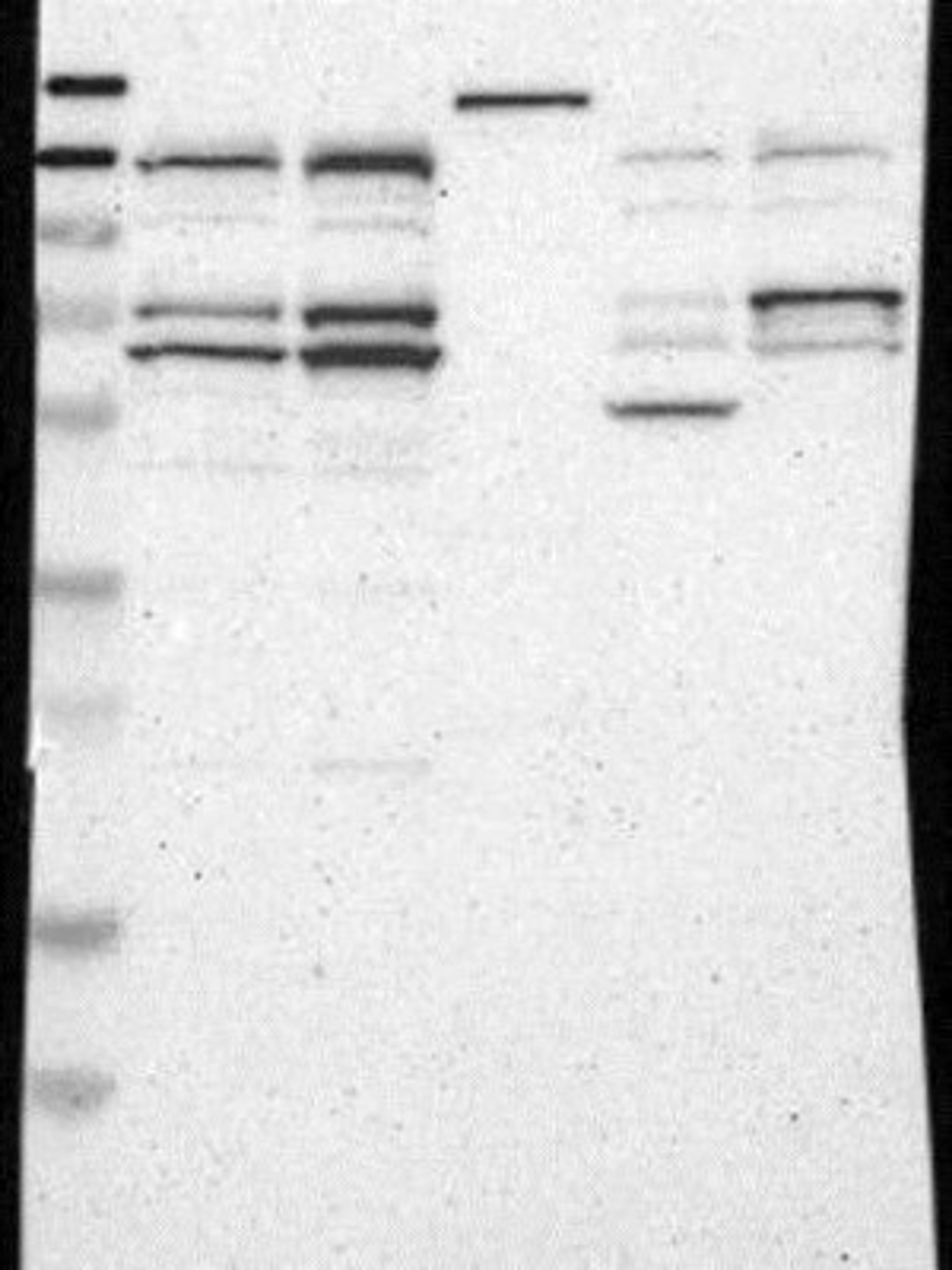 Western Blot: EDR1/PHC1 Antibody [NBP1-84009] - Lane 1: Marker [kDa] 230, 130, 95, 72, 56, 36, 28, 17, 11<br/>Lane 2: RT-4<br/>Lane 3: U-251 MG<br/>Lane 4: Human Plasma<br/>Lane 5: Liver<br/>Lane 6: Tonsil