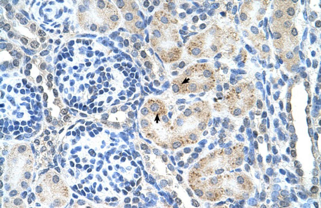 Antibody used in IHC on Human kidney.