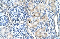 Antibody used in IHC on Human kidney.