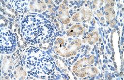 Antibody used in IHC on Human kidney.