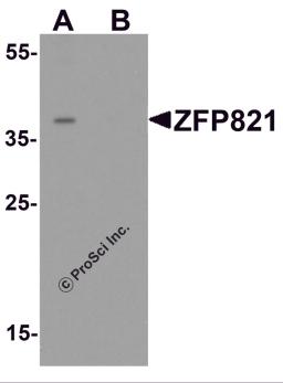 Western blot analysis of ZNF821 in Jurkat cell lysate with ZNF821 antibody at 0.5 &#956;g/ml in (A) the absence and (B) the presence of blocking peptide.