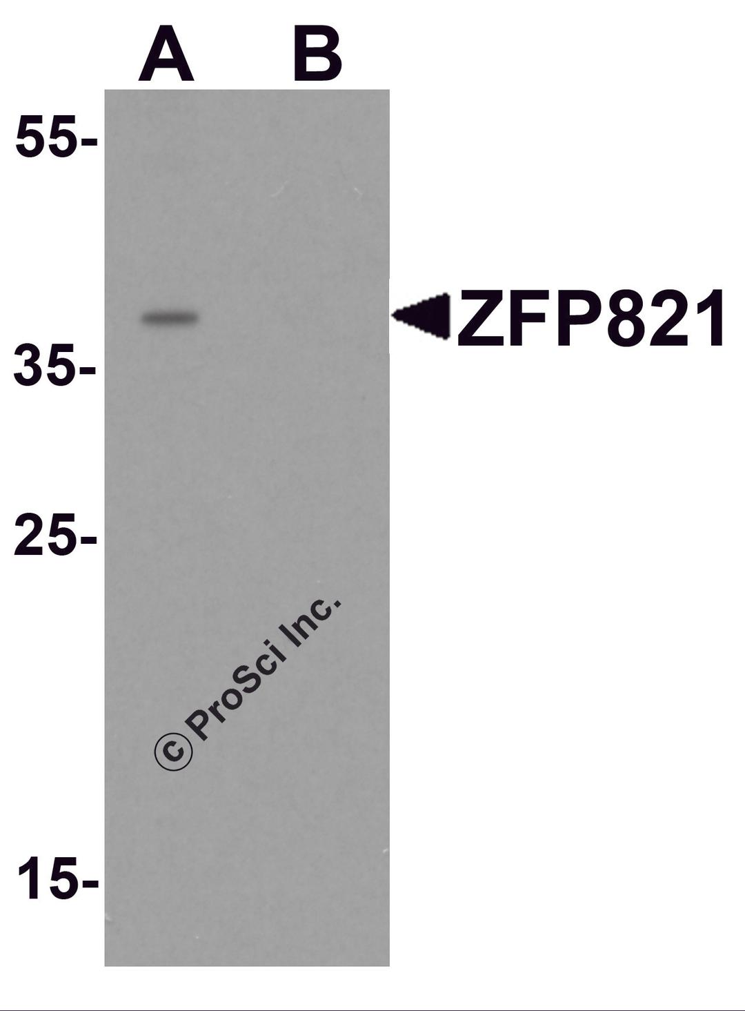 Western blot analysis of ZNF821 in Jurkat cell lysate with ZNF821 antibody at 0.5 μg/ml in (A) the absence and (B) the presence of blocking peptide.