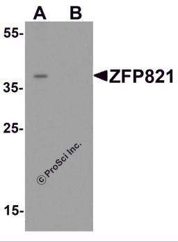 Western blot analysis of ZNF821 in Jurkat cell lysate with ZNF821 antibody at 0.5 μg/ml in (A) the absence and (B) the presence of blocking peptide.