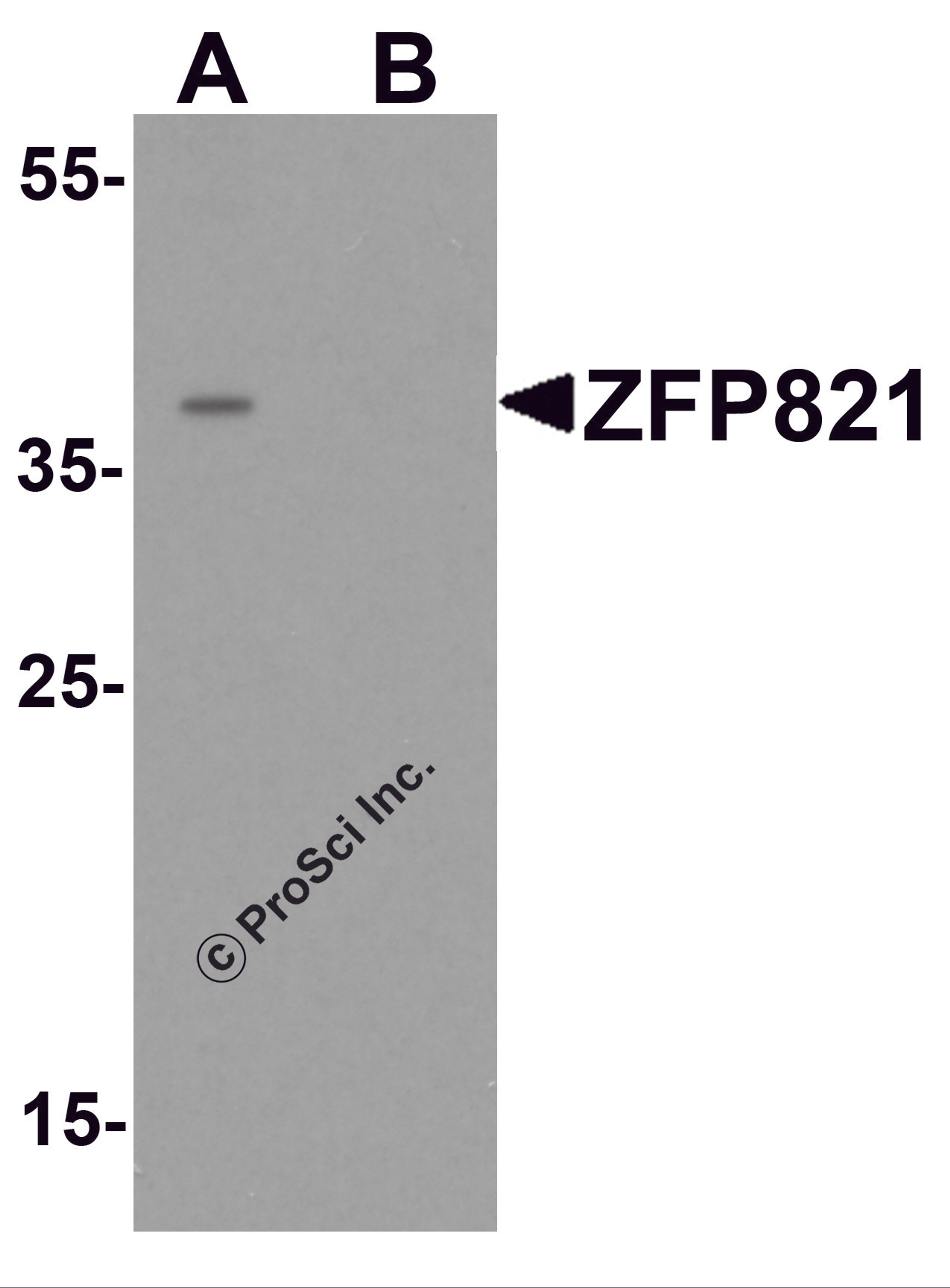 Western blot analysis of ZNF821 in Jurkat cell lysate with ZNF821 antibody at 0.5 μg/ml in (A) the absence and (B) the presence of blocking peptide.
