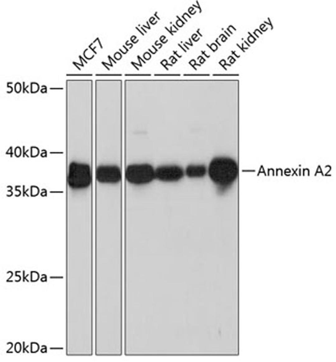 Western blot - Annexin A2 Rabbit mAb (A11235)