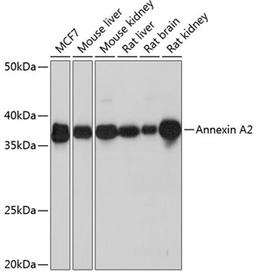 Western blot - Annexin A2 Rabbit mAb (A11235)