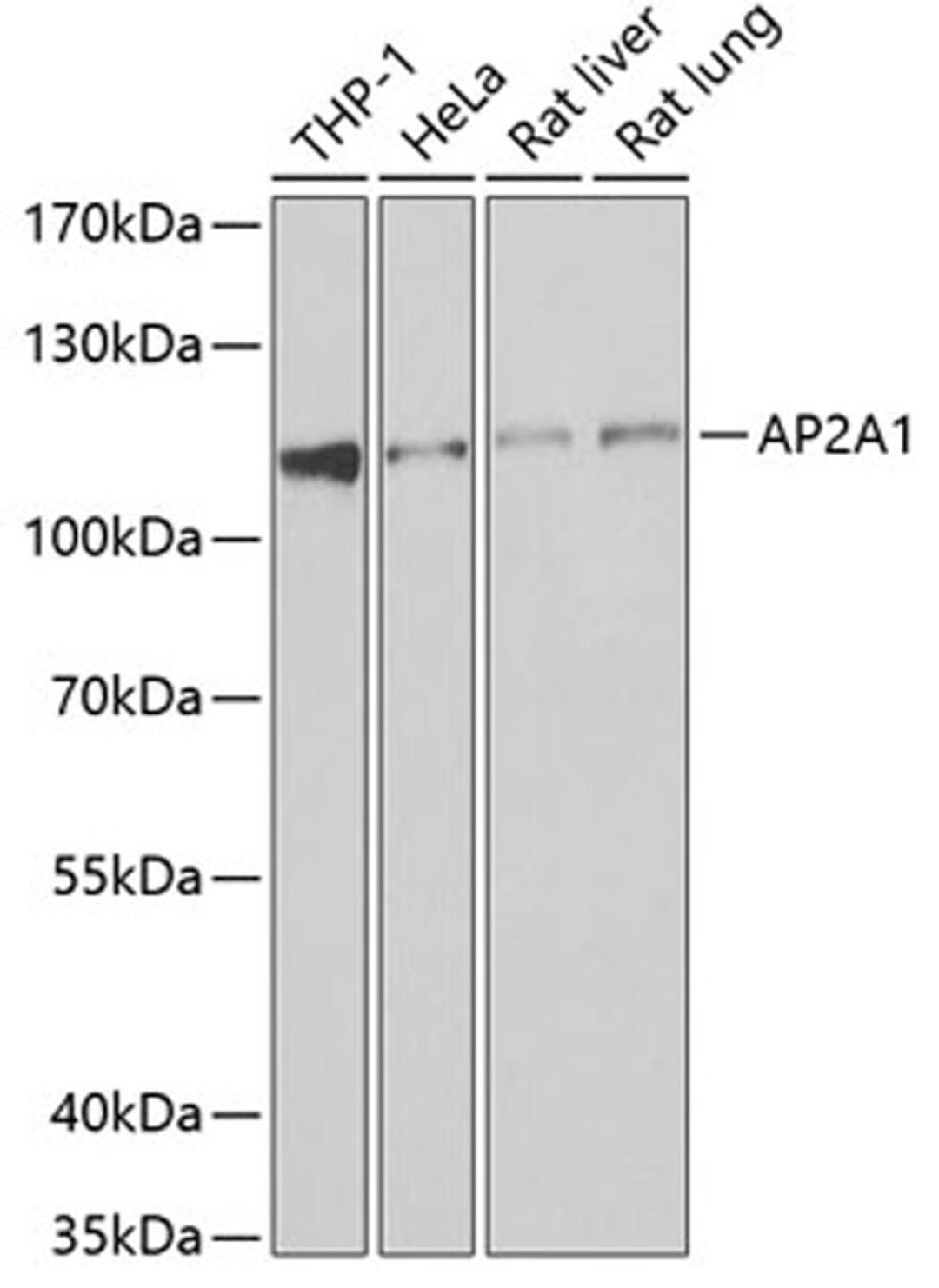 Western blot - AP2A1 antibody (A6863)