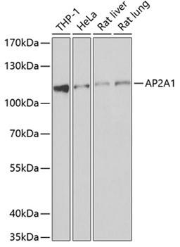 Western blot - AP2A1 antibody (A6863)