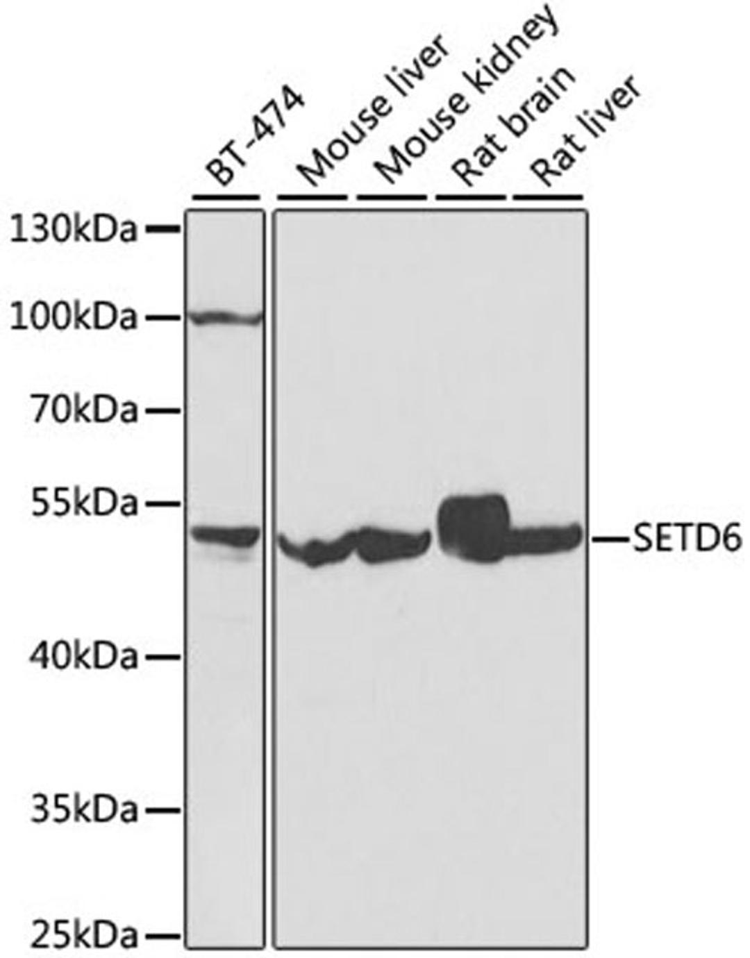 Western blot - SETD6 antibody (A7242)