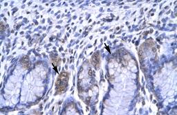 Antibody used in IHC on Human Stomach.