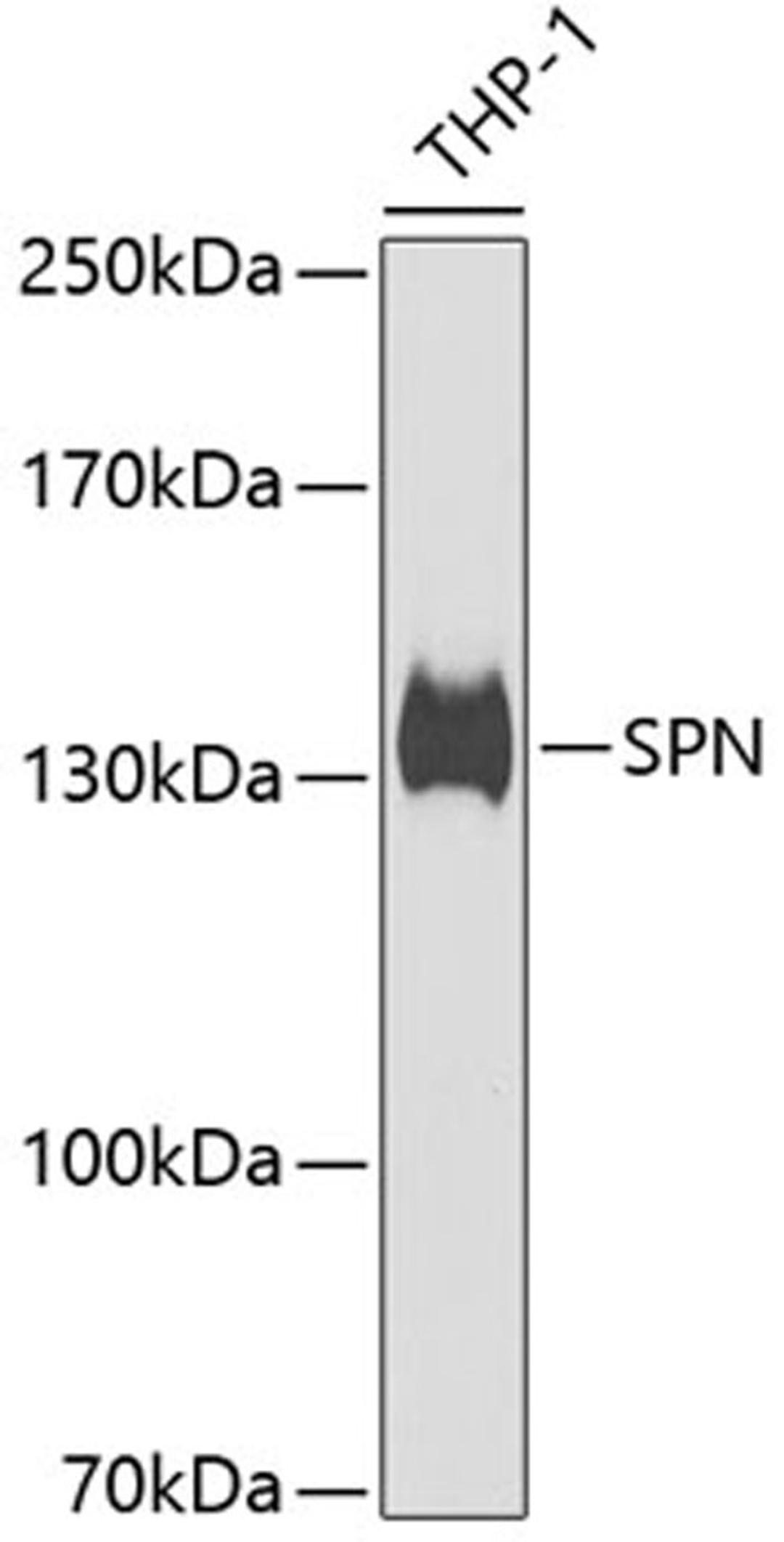 Western blot - SPN antibody (A6412)