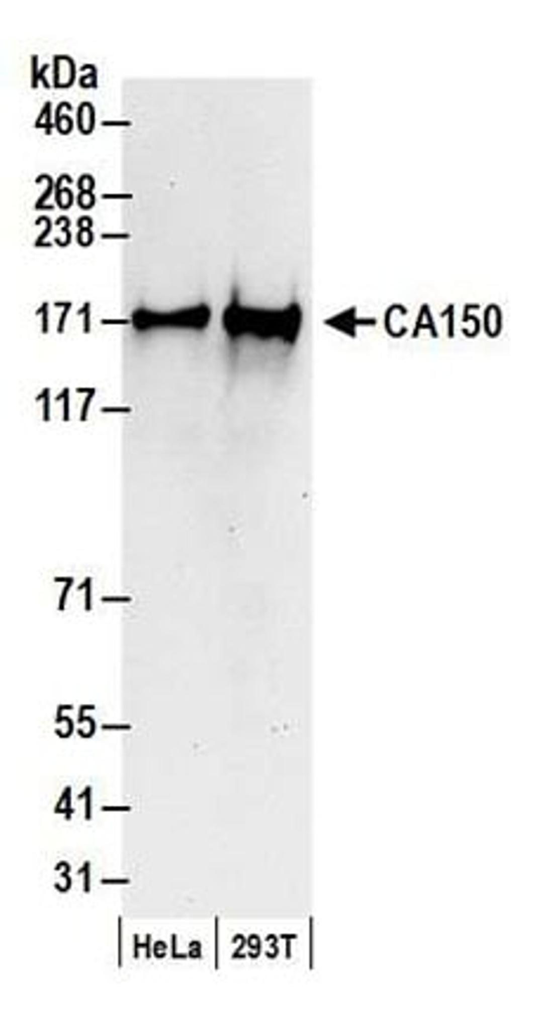 Detection of human CA150 by western blot.